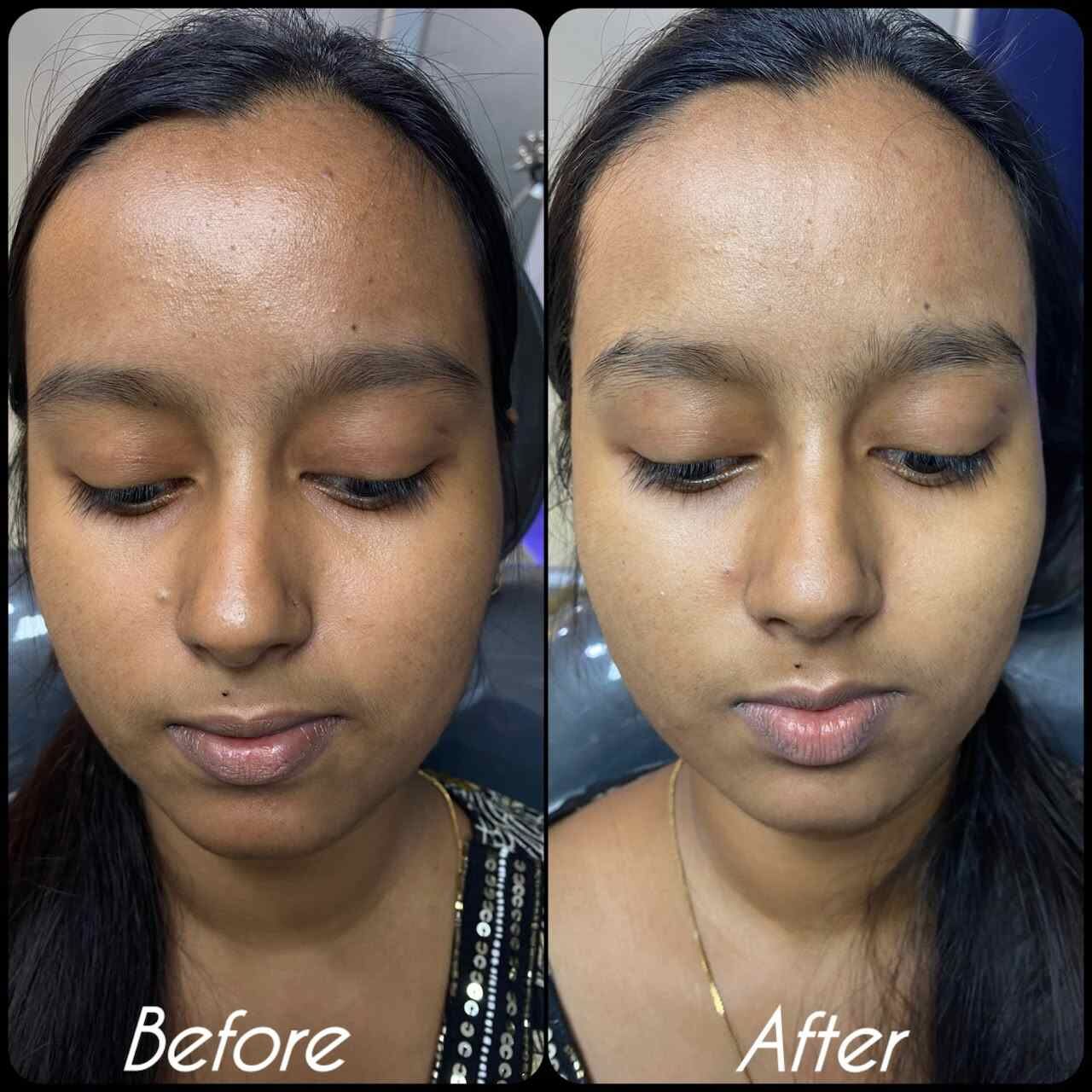 Kolkata, General, Achieve Clear, Healthy Skin With The Aesthetic House &ndash; Best Skin Clinic In Rajarhat