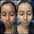 Achieve Clear, Healthy Skin With The Aesthetic House &ndash; Best Skin Clinic In Rajarhat