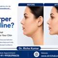 Want A Sharper Jawline? Find Out What May Work For Your Chin