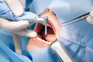 New Delhi, Dental, Dental Clinic In East Delhi