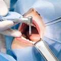 Dental Clinic In East Delhi