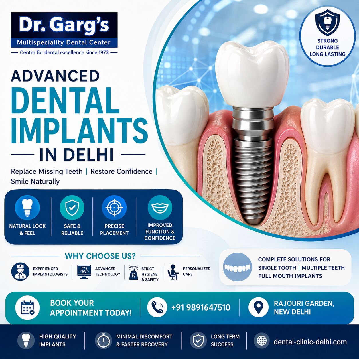 New Delhi, Dental, Advanced Dental Implants In Delhi | Dr. Garg&rsquo;s Multispeciality Dental Center