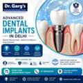 Advanced Dental Implants In Delhi | Dr. Garg&rsquo;s Multispeciality Dental Center