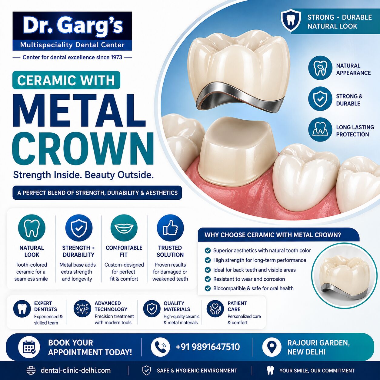 New Delhi, Dental, Ceramic With Metal Crown Treatment | Dr. Garg&rsquo;s Multispeciality Dental Center