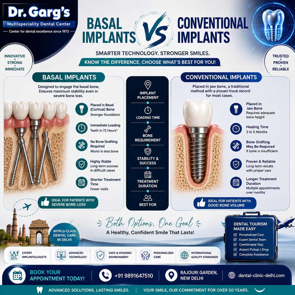 New Delhi, Dental, Basal Implants Vs Conventional Implants: Complete Guide | Dr. Garg&rsquo;s Dental Center