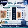 Basal Implants Vs Conventional Implants: Complete Guide | Dr. Garg&rsquo;s Dental Center