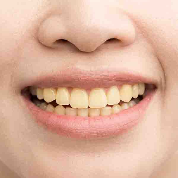 Kabul, Dental, Top Dental Oral Care Treatments In Peelamedu,Coimbatore
