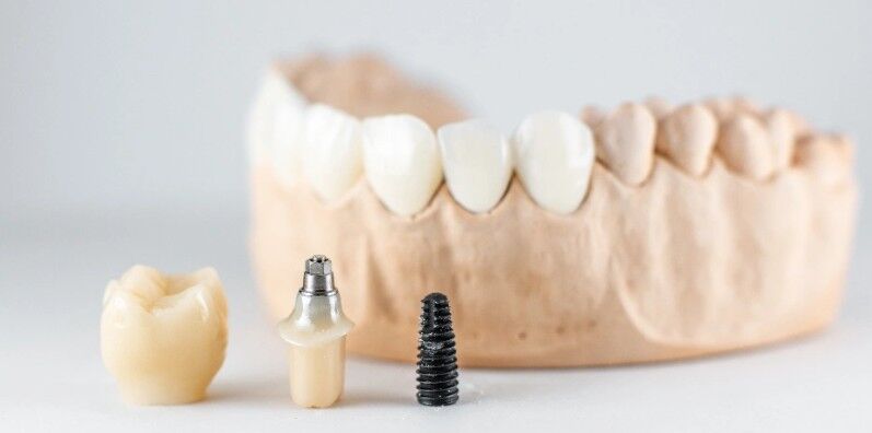 Abu Dhabi, Dental, Dental Crowns In Al Ain For Long-Lasting Care