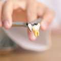Tooth Extraction In Al Ain For Expert Relief