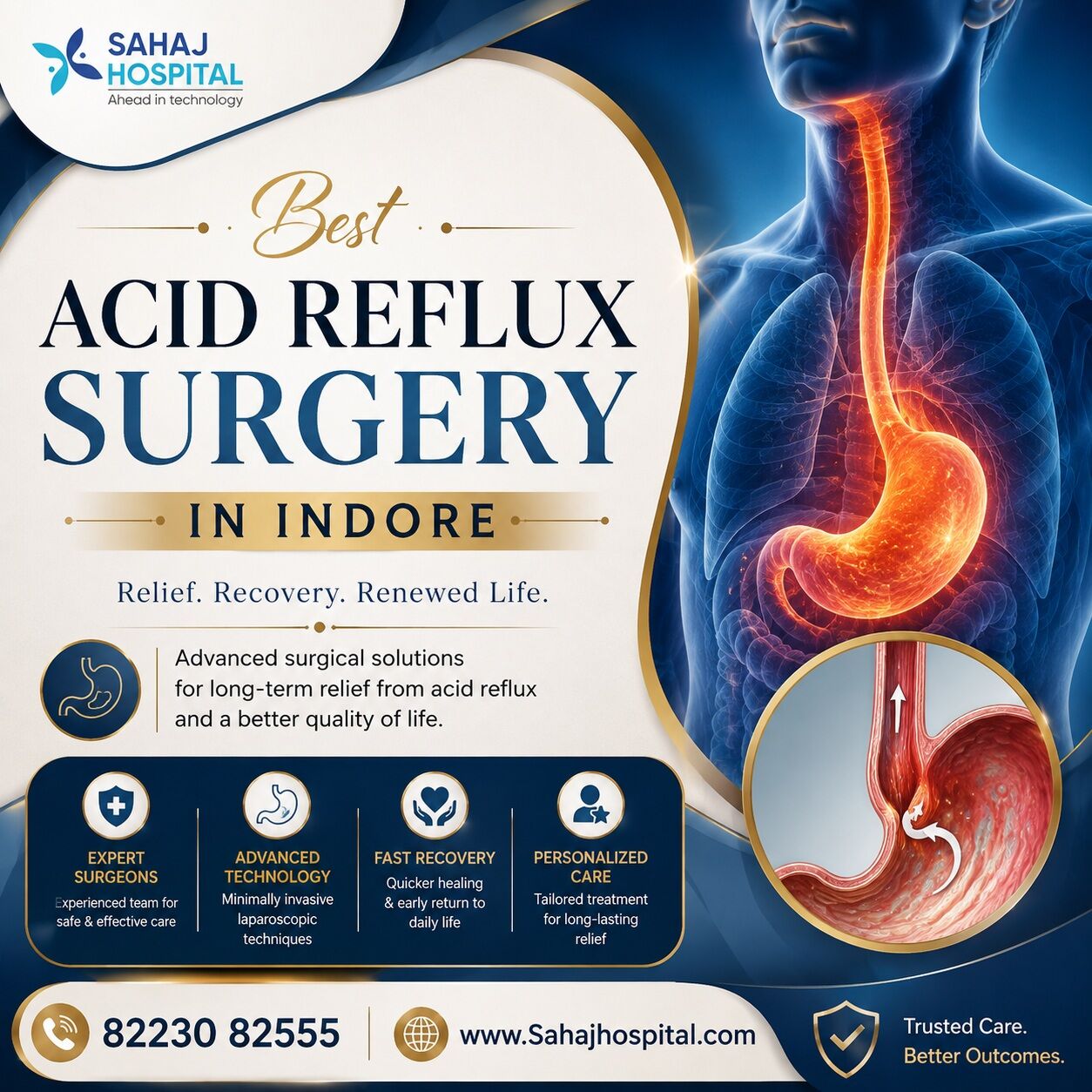 Indore, Health, Best Acid Reflux Surgery In Indore - Sahaj Hospital