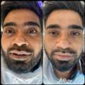 Expert Skin Care & Dark Circle Treatment At The Aesthetic House In Rajarhat
