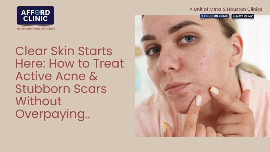 Al Nahda, Health, Clear Skin Starts Here: How To Treat Active Acne & Stubborn Scars Without Overpaying