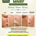 Best Skin Doctor In Suncity, Hyderabad For Advanced MNRF Treatment