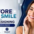 Specialized Smile Designing In Vile Parle, Mumbai | AK Dental Clinic