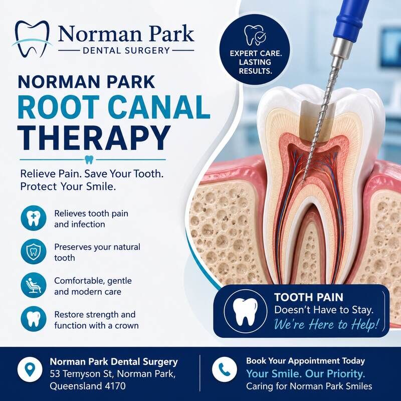 Sydney, Health, Norman Park Root Canal Therapy For Comfortable Dental Care