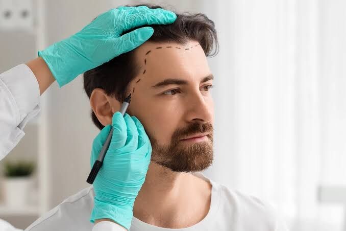 New Delhi, Health, Get Smooth Scalp, Fuller Hair With The Botox Hair Treatment!