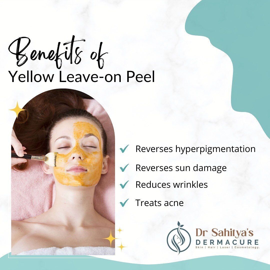 Kurnool, Health, Yellow Peel Treatment At Dermacure - Rajahmundry