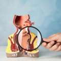 Fissure Treatment In Kalkaji &ndash; Metropiles Clinic