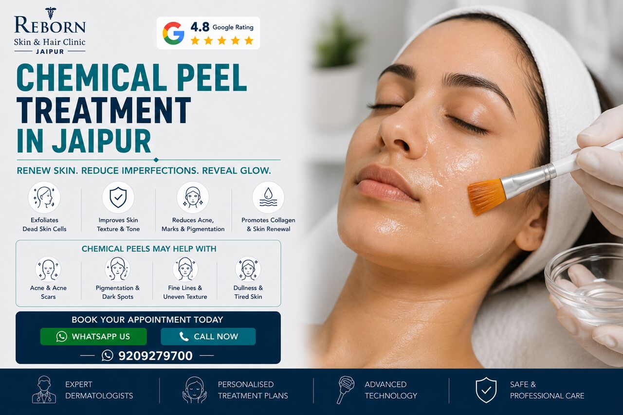 Jaipur, Health & Beauty Items, INR 2000,  Chemical Peeling Treatment In Jaipur For Uneven Skin Tone