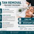 INR 2500,  Young & Active In Madhapur? Is Sun Exposure Adding More Tan?