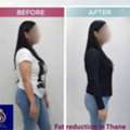 Achieve Your Body Goals With Fat Reduction In Thane &ndash; DNA Royal.
