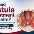 Need Fistula Treatment In Delhi? Connect With A Specialist Today