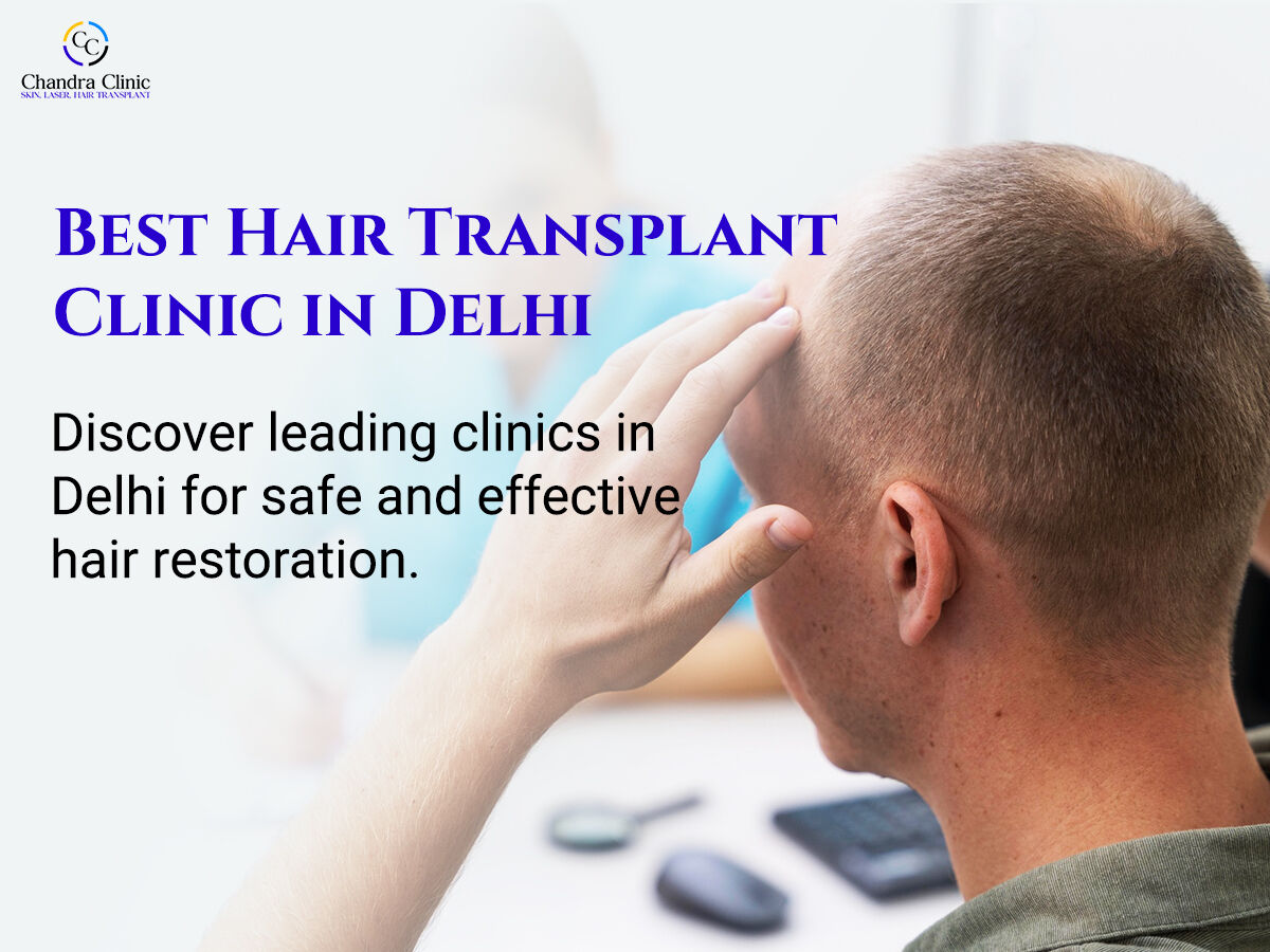 New Delhi, Health, Best Hair Transplant Clinic In Delhi: Expert Tips For Making The Right Choice