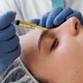 Prp Therapy With A Personalized Treatment Approach
