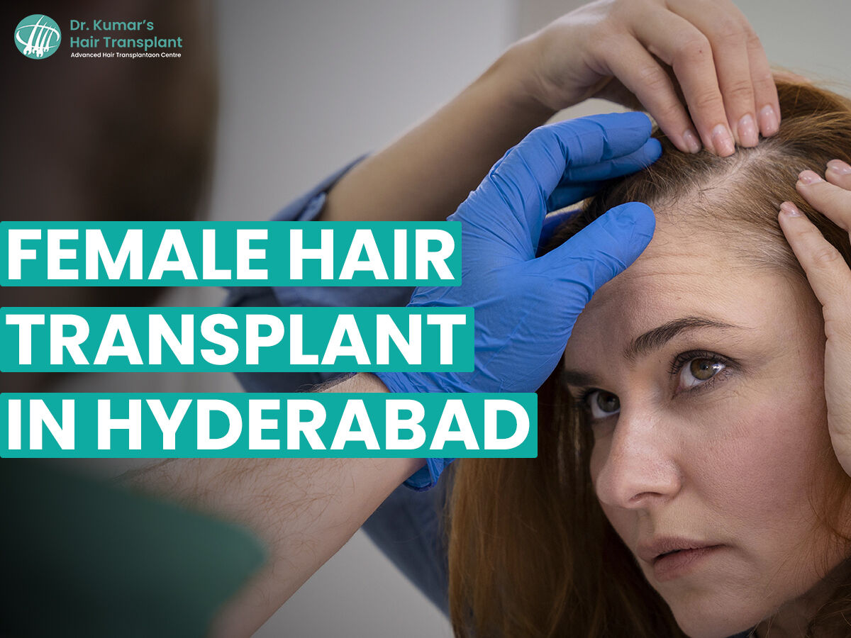 New Delhi, Health, Understanding Female Pattern Hair Loss: Transplant Solutions In Hyderabad