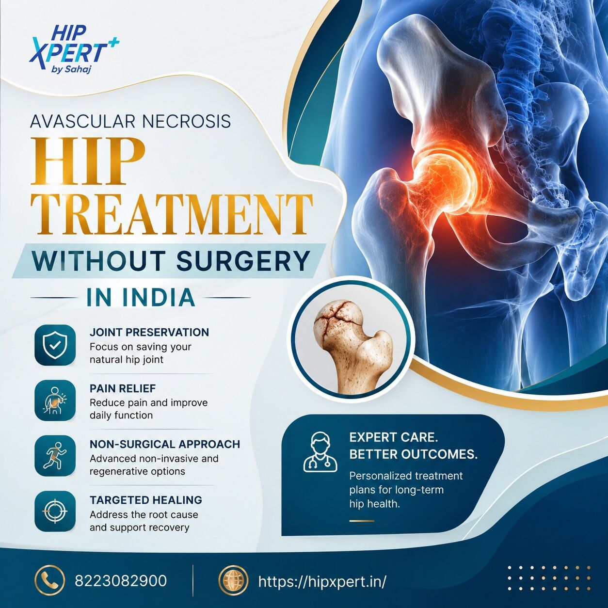 Indore, Health, Avascular Necrosis Hip Treatment Without Surgery In India