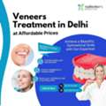 Get Affordable Dental Veneers Treatment In Delhi