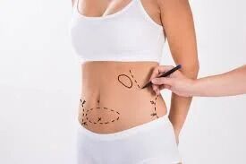 Pune, Medical, Body Contouring Tummy Tuck In Baner  - The Aesthetic Hub