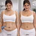 Post Pregnancy Tummy Tuck In Baner  - The Aesthetic Hub