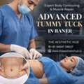 Advanced Tummy Tuck In Baner  - The Aesthetic Hub