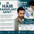 INR 29999,  Thinking About Hair Transplant In Banjara Hills?