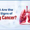 Best Pulmonolgy Hospital In Hyderabad