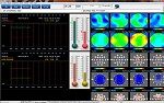New York, Health, QEEGPro Surface ZScore Training