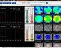 QEEGPro Surface ZScore Training