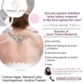Benefits Of Tattoo Removal Treatment - Derma One