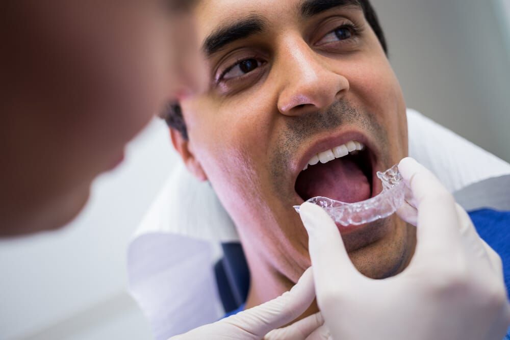 Madurai, Creative, DENTAL IMPLANTS IN MADURAI