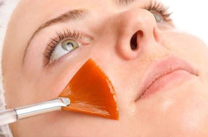 Singapore, Health, Carbon Laser Peel Treatment: Your Path To Engaging Beauty