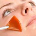 Carbon Laser Peel Treatment: Your Path To Engaging Beauty