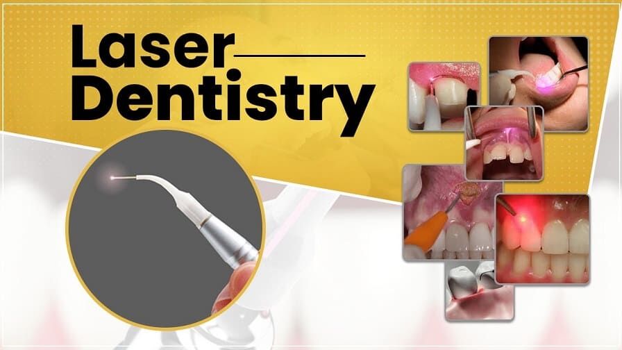 Hyderabad, Dental, Scared Of The Dentist? Try Painless Laser Dental Treatment!