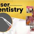 Scared Of The Dentist? Try Painless Laser Dental Treatment!