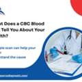 What Does A CBC Blood Test Tell You About Your Health?