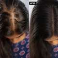 The Aesthetic House – Advanced Hair Care & Hair Restoration In Rajarhat