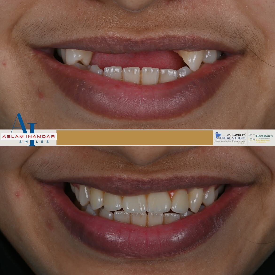 Muscat, Dental, Dentist In Mumbai Redefining Smiles With Digital Precision