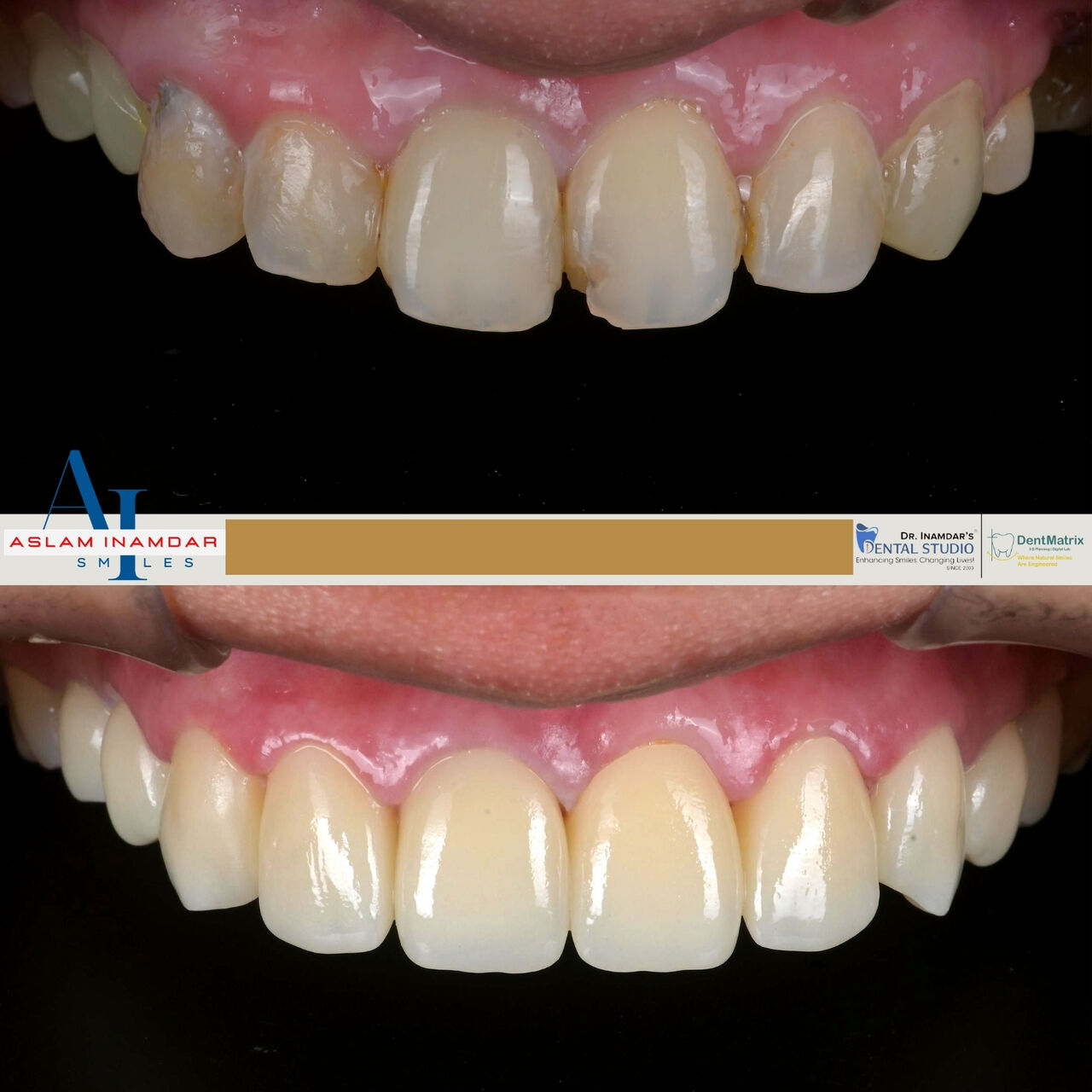 Muscat, Dental, Dentist In Mumbai Redefining Smiles With Digital Precision