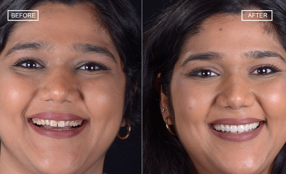 Muscat, Dental, Dentist In Mumbai Redefining Smiles With Digital Precision