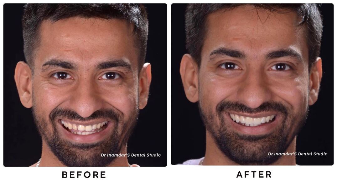 Muscat, Dental, Dentist In Mumbai Redefining Smiles With Digital Precision